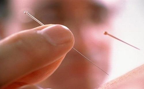 胃疼针灸哪个位置 胃疼针灸什么位置