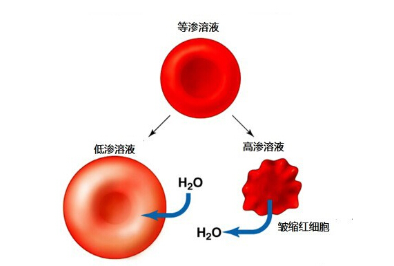 喝水太多的坏处 喝水太多有好处吗