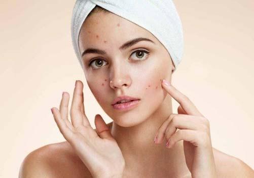 鼻子上长痘痘是什么原因 鼻子上长痘痘是什么原因引起的