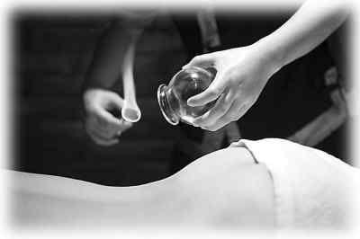 拔罐对身体有什么好处和坏处 拔罐对身体的好处和坏处