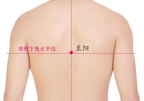 心绞痛拔罐位置图（心绞痛拔罐的位置图）