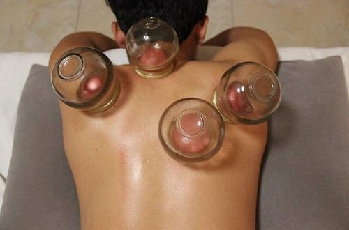 拔罐治疗湿疹吗（拔罐对湿疹有没有治疗效果的）