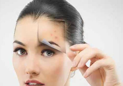 冬天脸上冻红怎么办 冬天冻红的脸怎么办小妙招