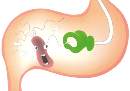 慢性胃炎是怎么引起的 慢性胃炎是怎么引起的脉紧