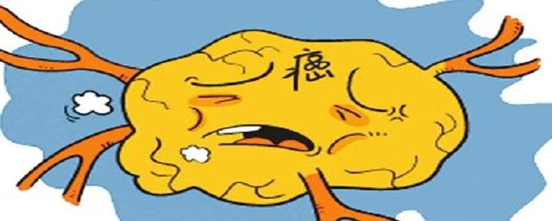 胃癌晚期症状表现有哪些 胃癌晚期的主要症状是什么