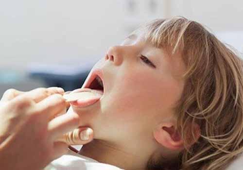 扁桃体发炎反复发烧39度怎么退烧 急性扁桃体炎发烧39度怎么退烧最快