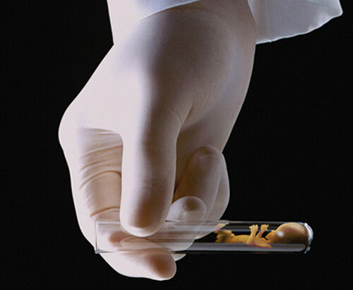 自然流产后多久来月经（自然流产后多久来月经算正常）