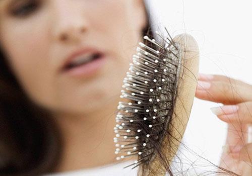 脱发严重是什么原因 脱发严重是什么原因引起的女性