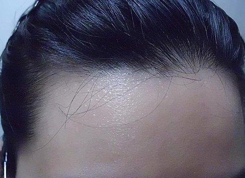 汗液颜色不同代表什么 汗液的颜色