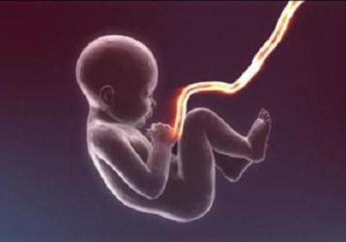 剪脐带是宝宝疼还是妈妈疼(脐带剪掉宝宝疼还是妈妈疼)