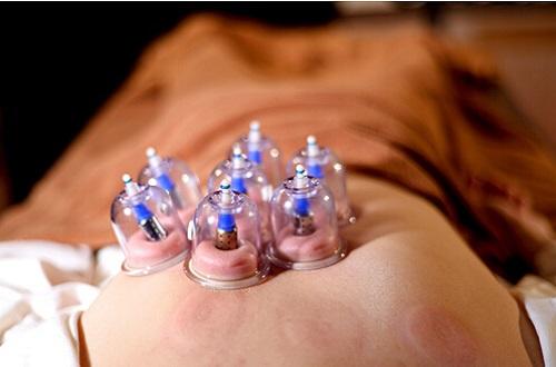 拔罐可以治疗失眠吗（拔罐可以治疗睡眠吗）