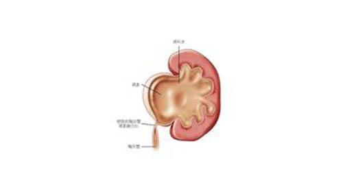 肾积水有哪些症状 5岁儿童肾积水有哪些症状