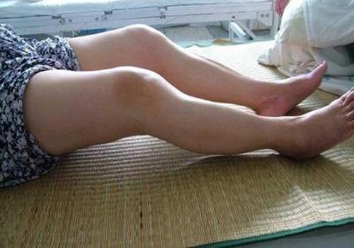 骨关节炎是什么症状(骨关节炎是什么症状?)