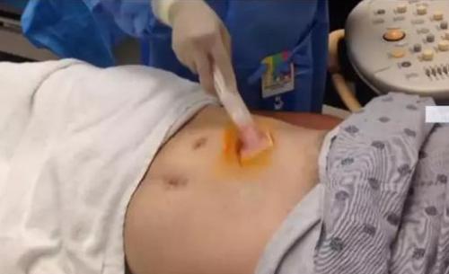 肝穿刺活检是什么意思（查肝穿刺活检是什么意思）