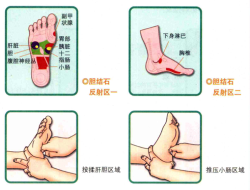 胆结石按什么什么穴位有效（胆结石在哪个部位）