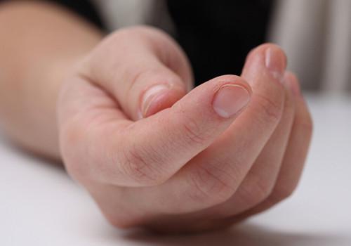 打球手指戳伤怎么办 打球手指戳伤怎么办视频