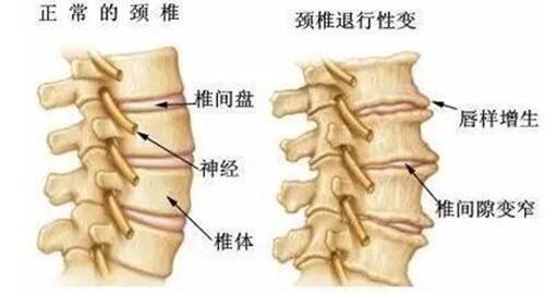 腰酸背痛是什么原因引起的（经期腰酸背痛是什么原因引起的）