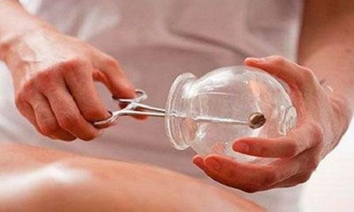 拔罐可以治疗面瘫吗 拔罐能治疗面瘫吗