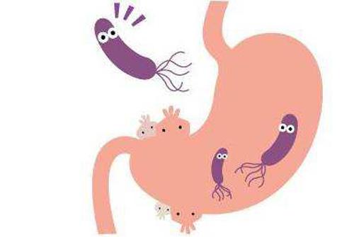 幽门螺杆菌阳性严重吗（胃幽门螺杆菌抗体阳性严重吗）