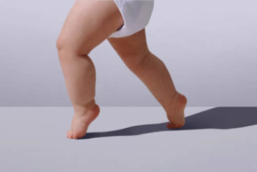 宝宝走路外八字怎么办(16个月宝宝走路外八字怎么办)