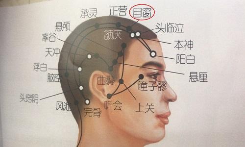 目窗的准确位置图 目窗的准确位置图和作用