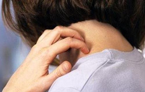 黄疸皮肤瘙痒的原因 胆汁淤积性黄疸皮肤瘙痒的原因