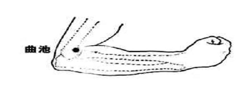 曲池针刺方法 针刺曲池的针感