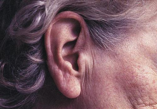 脑供血不足会引起耳鸣吗(脑供血不足会引起耳鸣吗?)