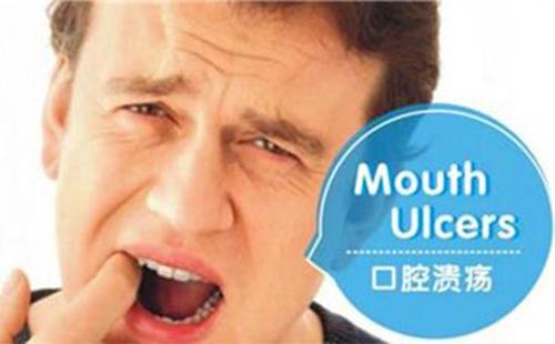 口腔溃疡怎么办(口腔溃疡怎么办怎么快速消除)