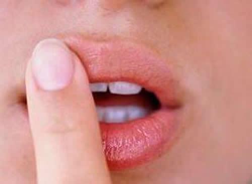 烂嘴角是怎么回事 孩子烂嘴角是怎么回事