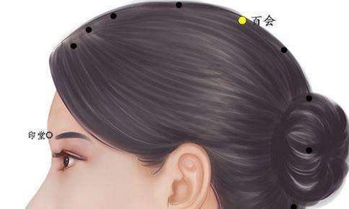 失眠针灸哪里最好 失眠可以针灸效果好吗