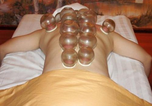 拔罐水泡刺破还是不刺破好的快 拔罐有水泡可以刺破吗