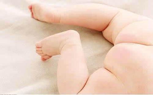 宝宝屁股红怎么回事（10个月的宝宝屁股红怎么回事）