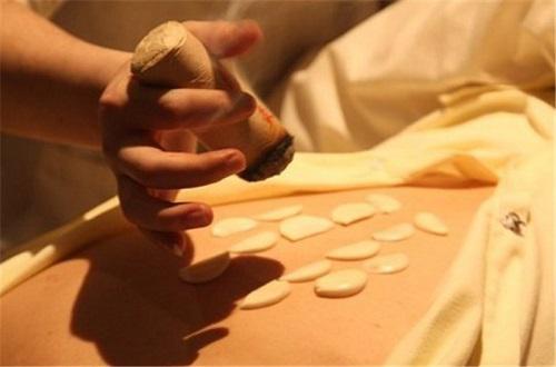 经期艾灸的作用和禁忌（经期适宜艾灸吗?）