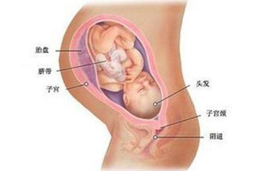 胎盘后置好不好 胎盘后置好不好治疗