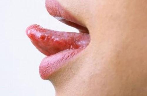 夏天容易上火怎么办 夏天容易上火怎么办多吃什么水果