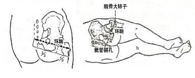 环跳的准确位置图视频 环跳的准确位置图视频及功放