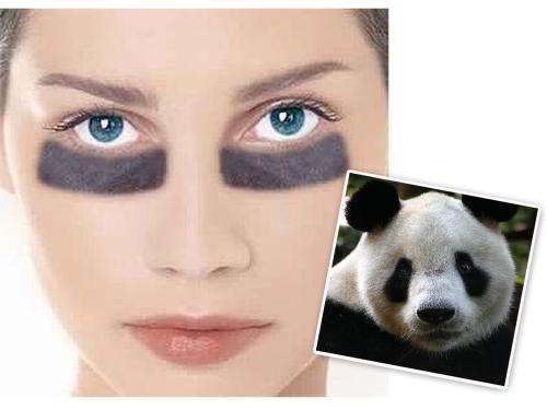 黑眼圈很重是有什么病吗(黑眼圈很重是有什么病吗)