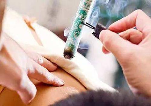 艾灸后的禁忌 艾灸后的禁忌有哪些