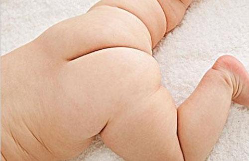 宝宝屁股红的原因 宝宝屁股红的原因图片