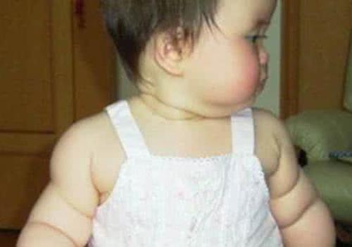 宝宝太胖有什么危害 宝宝肥胖的危害