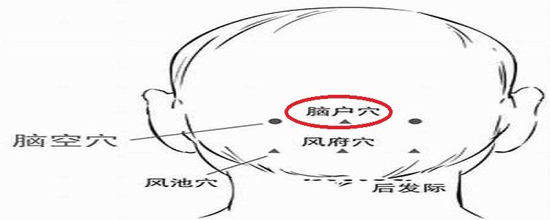 脑户的位置图片（脑户的准确位置图片）