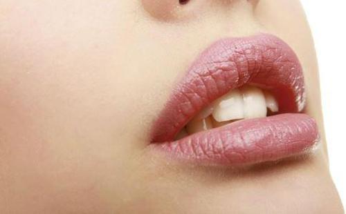 嘴角烂了怎么办 上火嘴角烂了怎么办