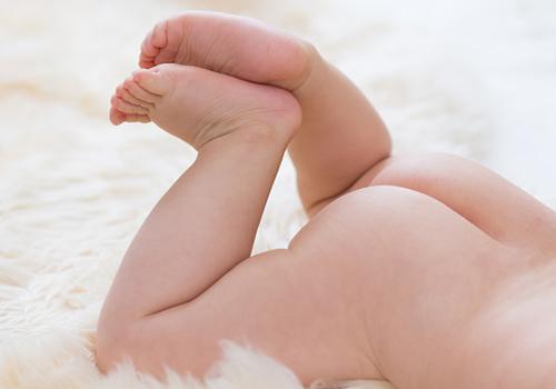 宝宝红屁股怎么办 如何预防宝宝红屁股