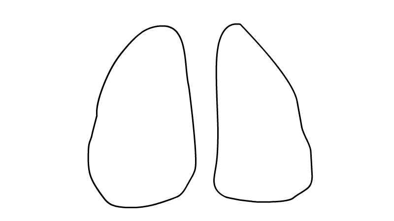 肺炎卡通简笔画画法步骤