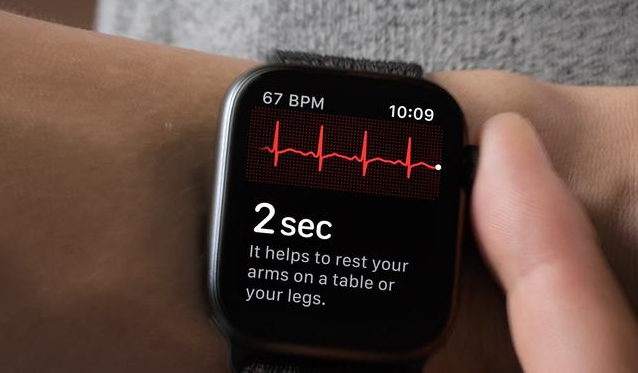 Apple Watch Series 4蜂窝网络款心电图怎么样