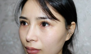 眼袋怎么去掉 平时要注意什么