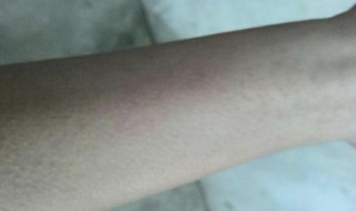 吃东西过敏了怎么办 导致过敏的原因