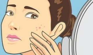 脸上长斑如何调理 调理脸上长斑的方法