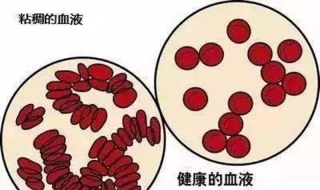 血稠怎么办 血粘稠怎么治疗